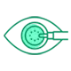 Cataract